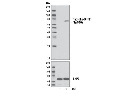 Western Blotting Image 1: Phospho-SHP-2 (Tyr580) (D66F10) Rabbit mAb