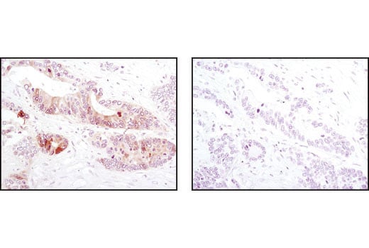 Immunohistochemistry Image 4: Phospho-4E-BP1 (Thr37/46) (236B4) Rabbit mAb