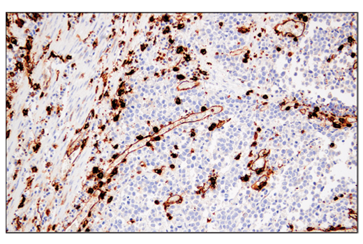 undefined Image 34: Late-Onset Alzheimer's Disease Risk Gene Antibody Sampler Kit