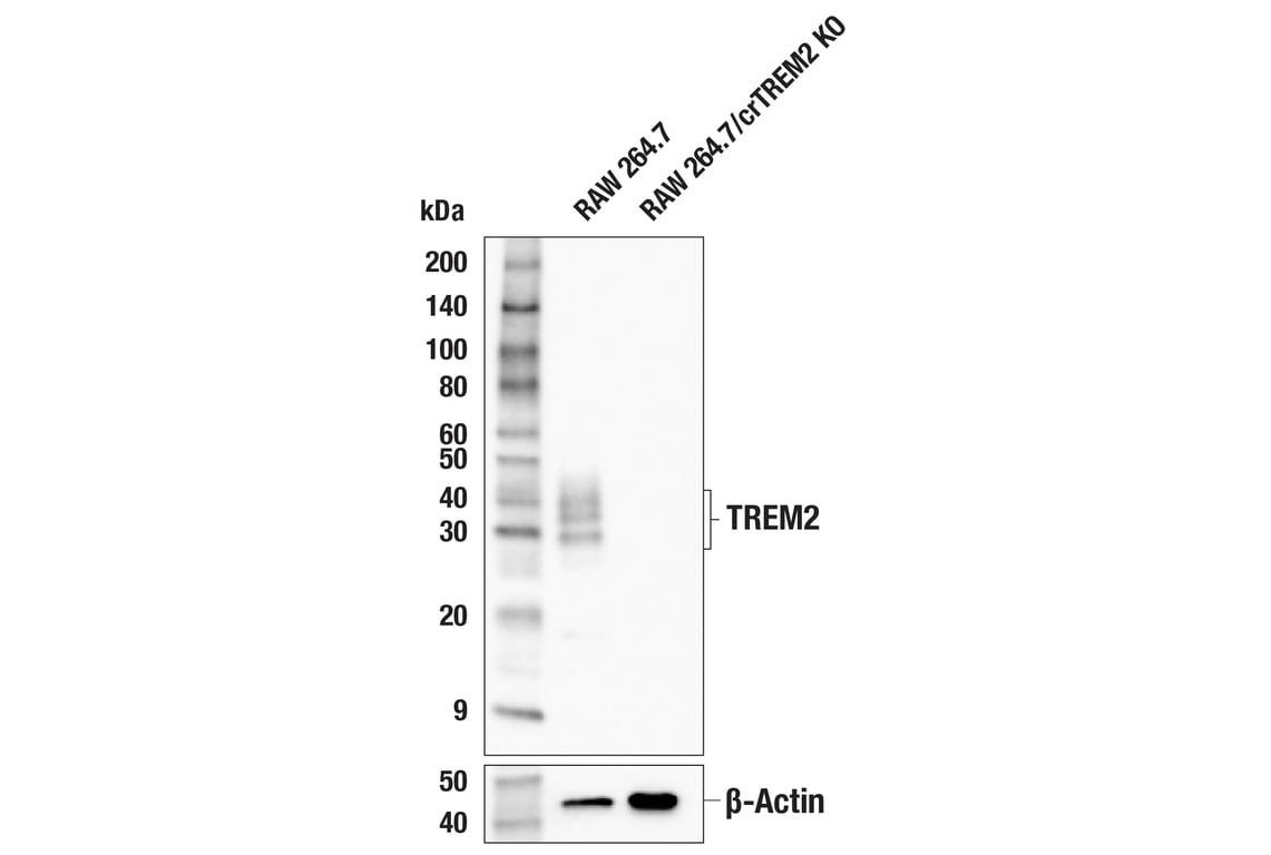 Western Blotting Image 1: TREM2 (E7O7Q) Rabbit mAb (BSA and Azide Free)