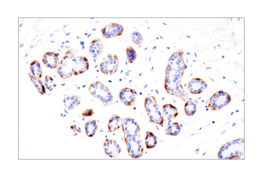 Immunohistochemistry Image 2: S100A1 (4C4.9) Mouse mAb