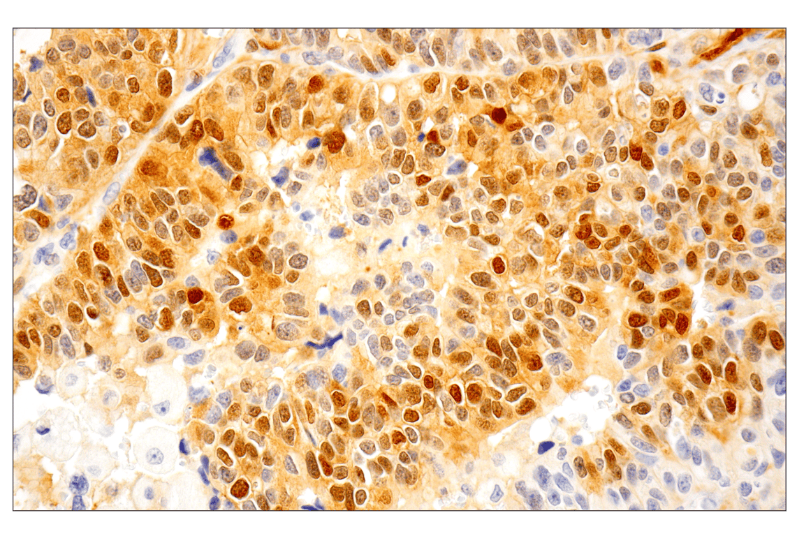 Phospho-p44/42 MAPK (Erk1/2) (Thr202/Tyr204) (D13.14.4E) XP