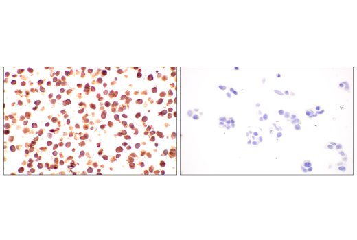Immunohistochemistry Image 11: p16 INK4A (BC42) Mouse mAb