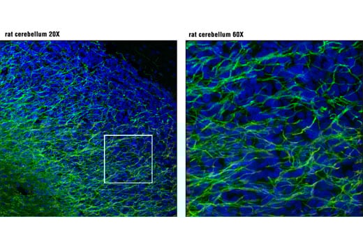 undefined Image 37: Demyelinating Disease Targets Antibody Sampler Kit