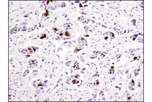 Immunohistochemistry Image 1: Topoisomerase IIα (D10G9) XP<sup>®</sup> Rabbit mAb