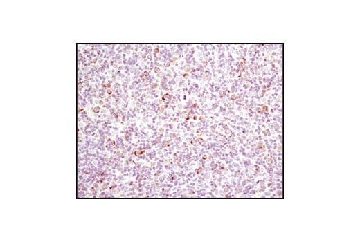 undefined Image 27: Pro-Apoptosis Bcl-2 Family Antibody Sampler Kit II
