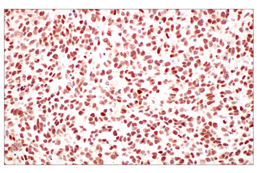 Immunohistochemistry Image 12: TIF1α/TRIM24 (E9T3N) Rabbit mAb