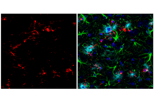 Immunofluorescence Image 2: CD68 (E3O7V) Rabbit mAb