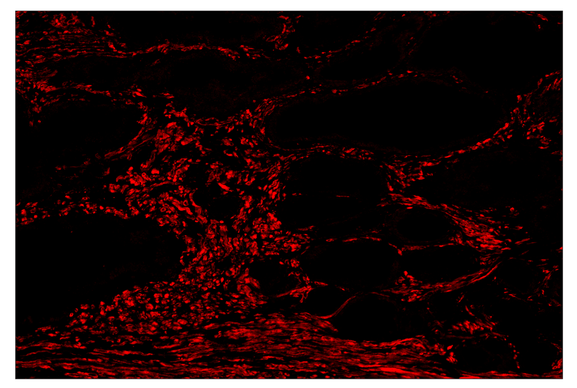 Immunohistochemistry Image 4: OX40L (D6K7R) & CO-0087-594 SignalStar<sup>™</sup> Oligo-Antibody Pair