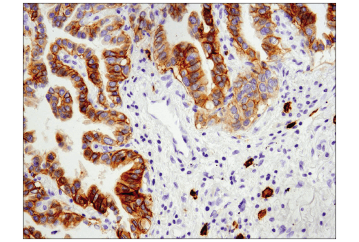 Immunohistochemistry Image 1: c-Kit (D3W6Y) XP<sup>®</sup> Rabbit mAb (BSA and Azide Free)