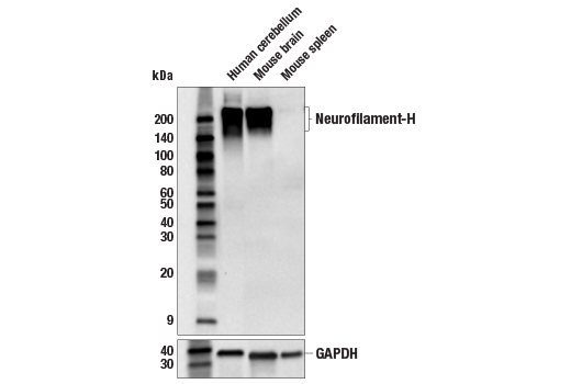 Western Blotting Image 1: Neurofilament-H (E7Z7G) Rabbit mAb