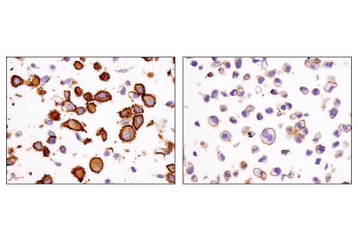 Immunohistochemistry Image 2: IQGAP1 (D8K4X) XP<sup>®</sup> Rabbit mAb