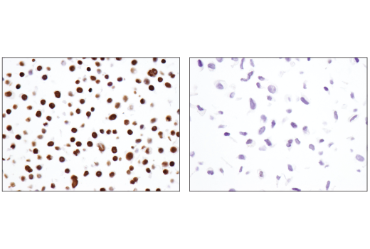 undefined Image 37: BAF Complex IHC Antibody Sampler Kit