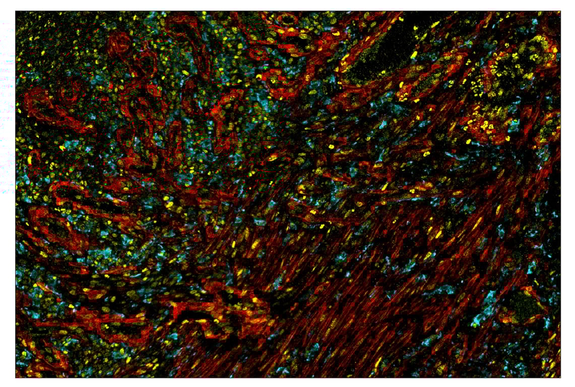 Immunohistochemistry Image 1: α-Smooth Muscle Actin (D4K9N) & CO-0024-488 SignalStar<sup>™</sup> Oligo-Antibody Pair