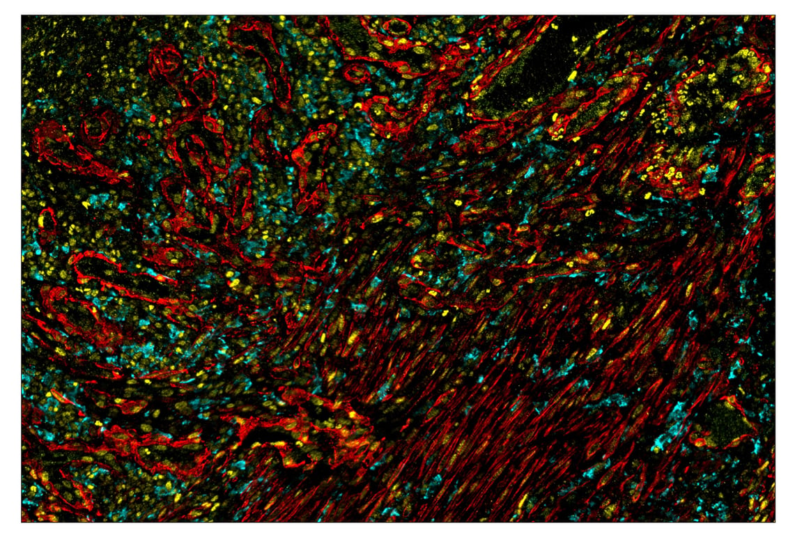 Immunohistochemistry Image 1: α-Smooth Muscle Actin (D4K9N) & CO-0024-594 SignalStar<sup>™</sup> Oligo-Antibody Pair