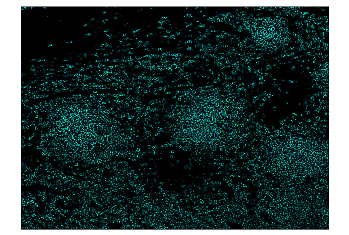 Immunohistochemistry Image 5: CD20 (E7B7T) & CO-0011-750 SignalStar<sup>™</sup> Oligo-Antibody Pair