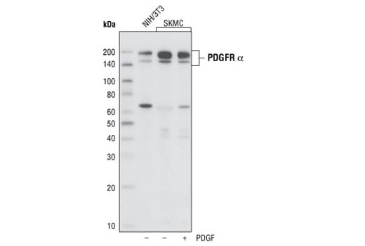 Western Blotting Image 1: PDGF Receptor α (D1E1E) XP<sup>®</sup> Rabbit mAb