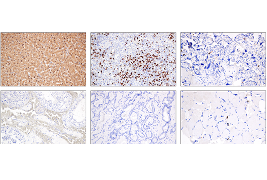 Immunohistochemistry Image 3: Arginase-1 (E4U1I) Mouse mAb (BSA and Azide Free)