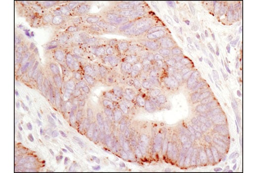 undefined Image 13: Rag and LAMTOR Antibody Sampler Kit