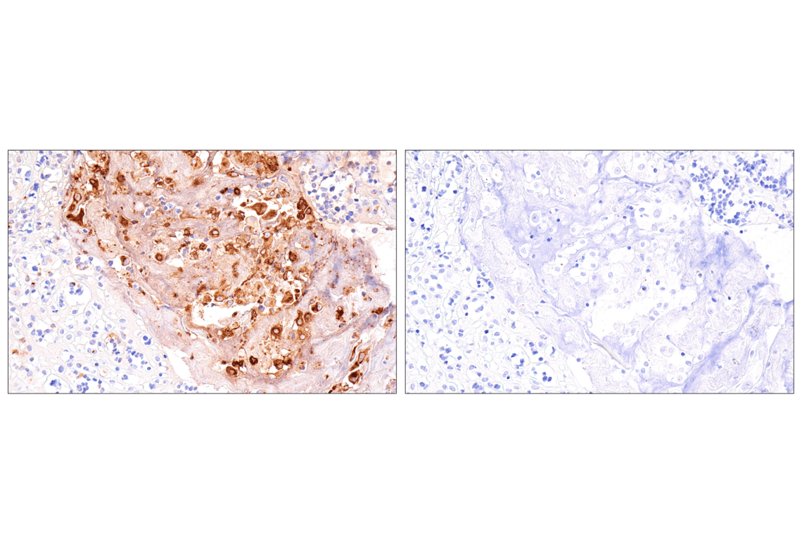 Immunohistochemistry Image 3: IL-8 (E5F5Q) XP<sup>®</sup> Rabbit mAb (BSA and Azide Free)