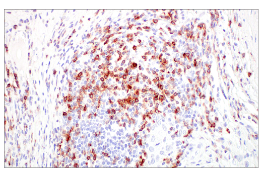 Immunohistochemistry Image 8: CD7 (E4G1Q) XP<sup>®</sup> Rabbit mAb (BSA and Azide Free)