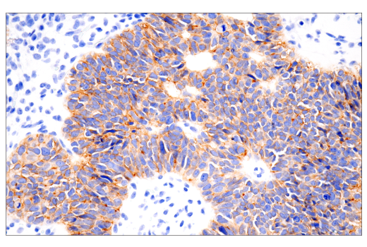 Immunohistochemistry Image 1: Claudin-6 (E7U2O) XP<sup>®</sup> Rabbit mAb