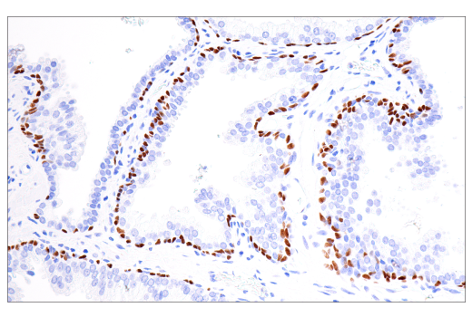 Immunohistochemistry Image 1: p40 (BC28) Mouse mAb