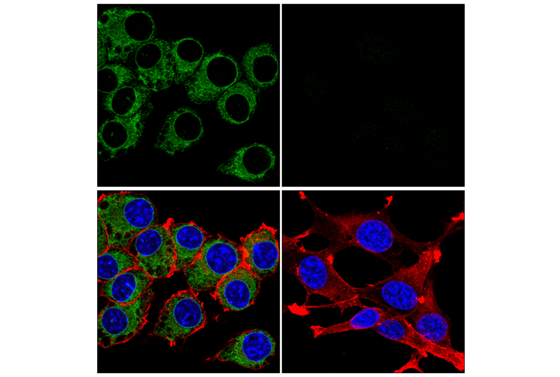 Immunofluorescence Image 1: STING (E9X7F) Rabbit mAb