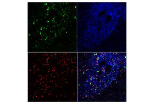 Immunofluorescence Image 1: IL-2Rα/CD25 (E9W2J) XP<sup>®</sup> Rabbit mAb