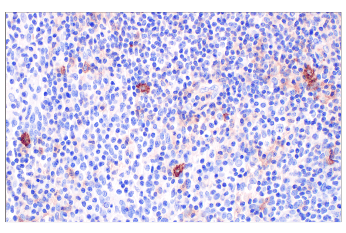 Immunohistochemistry Image 2: GLIPR2 (F7H7V) Rabbit mAb
