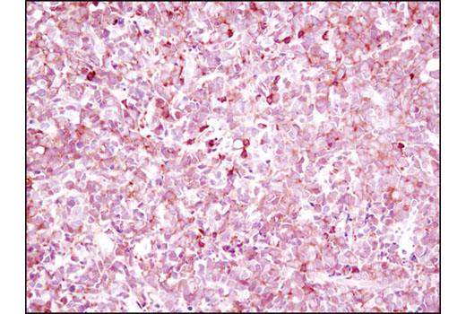 Immunohistochemistry Image 3: NFAT1 (D43B1) XP<sup>®</sup> Rabbit mAb (BSA and Azide Free)