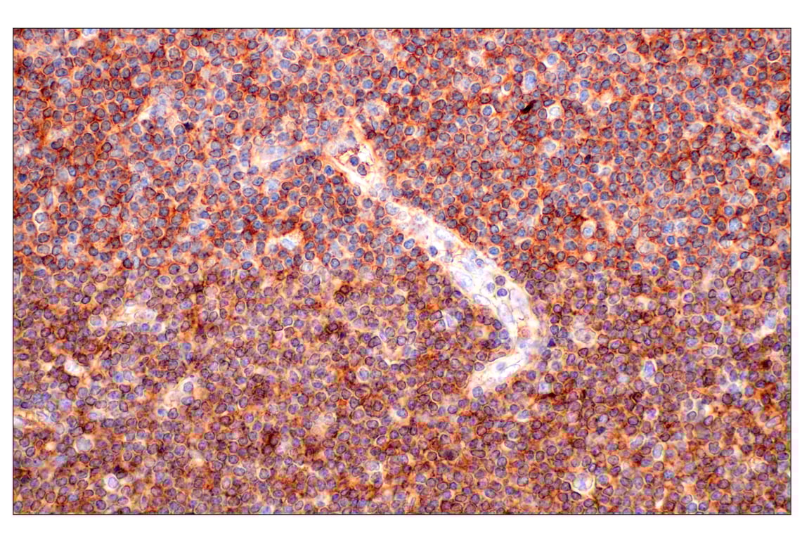 Immunohistochemistry Image 1: CD62L/L-Selectin (E7X9I) Rabbit mAb (BSA and Azide Free)