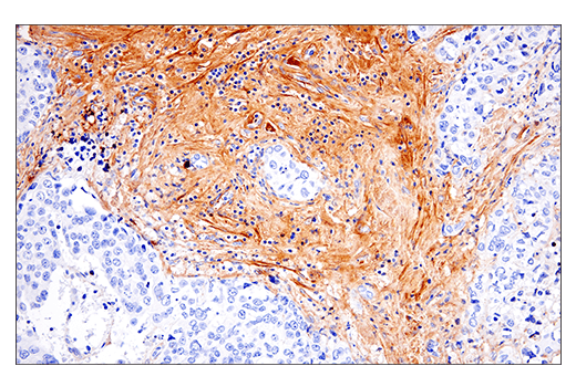 undefined Image 40: Extracellular Matrix Dynamics Antibody Sampler Kit