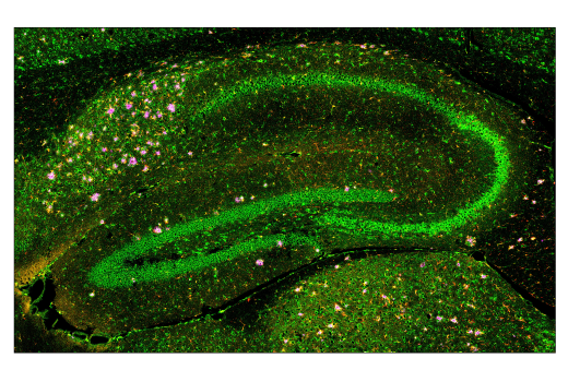 Immunofluorescence Image 2: Cathepsin D (E7Z4L) XP<sup>®</sup> Rabbit mAb
