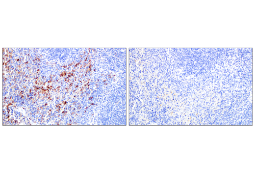 Immunohistochemistry Image 8: CD206/MRC1 (E6T5J) XP<sup>®</sup> Rabbit mAb (BSA and Azide Free)