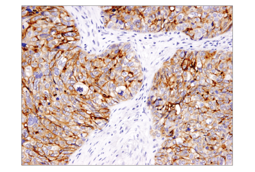 Immunohistochemistry Image 1: B7-H4 (D1M8I) XP<sup>®</sup> Rabbit mAb (BSA and Azide Free)