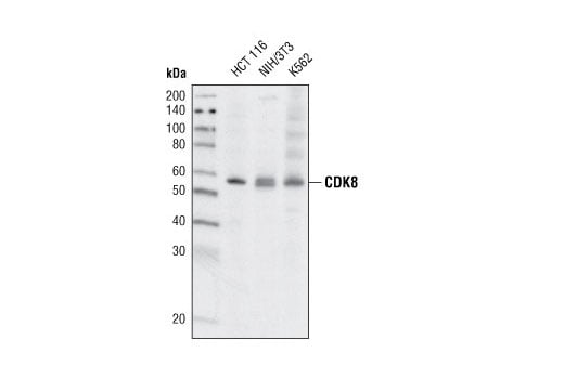 Western Blotting Image 1: CDK8 (G398) Antibody