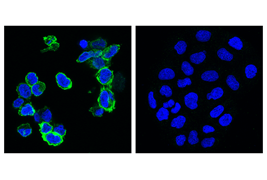undefined Image 90: Human Exhausted CD8<sup>+</sup> T Cell IHC Antibody Sampler Kit