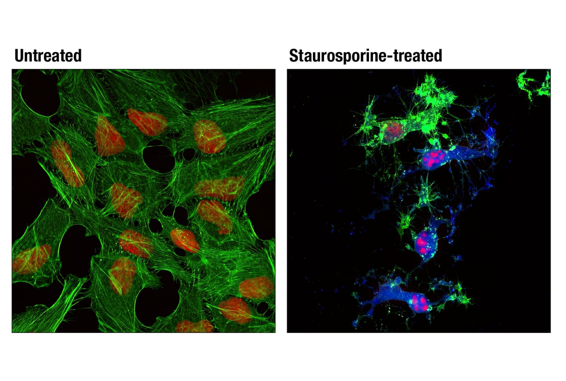 Immunofluorescence Image 1: Cleaved Caspase-3 (Asp175) (D3E9) Rabbit mAb (Alexa Fluor<sup>®</sup> 647 Conjugate)