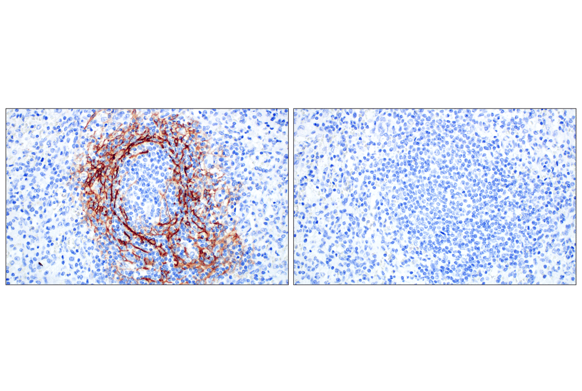 Immunohistochemistry Image 6: MAdCAM-1 (E1V8F) Rabbit mAb