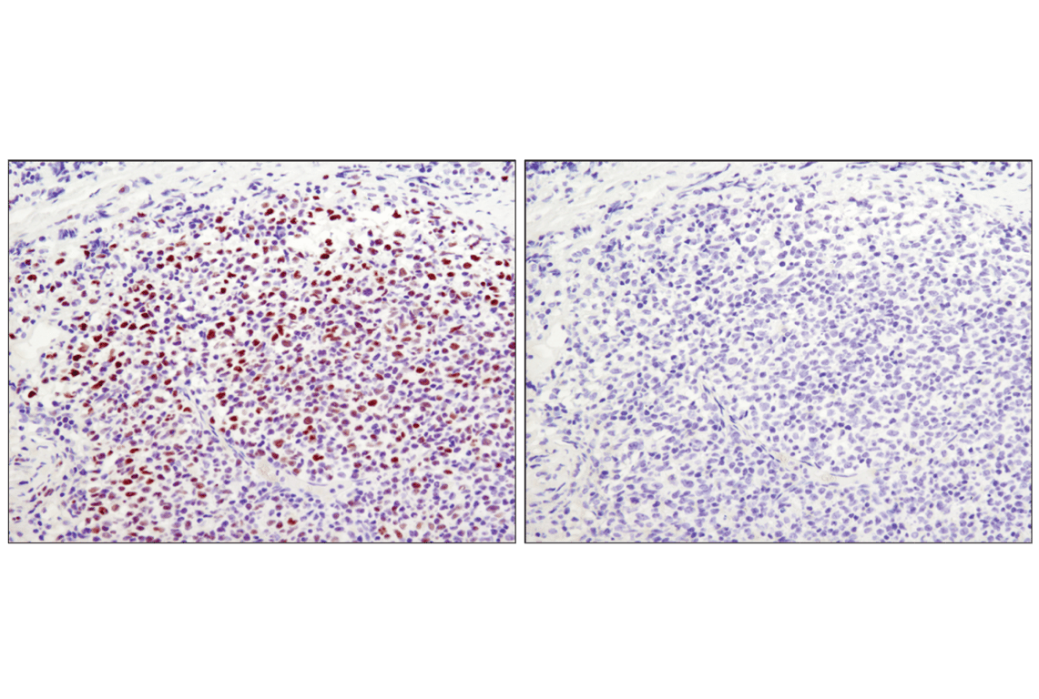 Immunohistochemistry Image 1: Tri-Methyl-Histone H3 (Lys27) (C36B11) Rabbit mAb