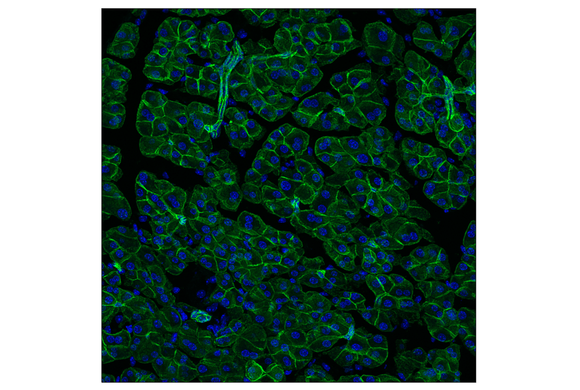 undefined Image 10: Cadherin-Catenin Antibody Sampler Kit