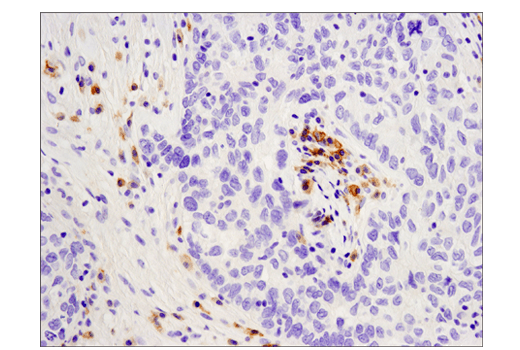 Immunohistochemistry Image 1: CD19 (Intracellular Domain) (D4V4B) XP<sup>®</sup> Rabbit mAb