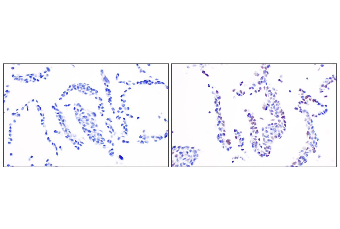 undefined Image 26: Non-Homologous End Joining (NHEJ) DNA Repair Antibody Sampler Kit