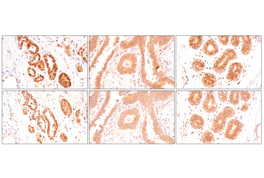 Immunohistochemistry Image 12: p70 S6 Kinase (E8K6T) XP<sup>®</sup> Rabbit mAb