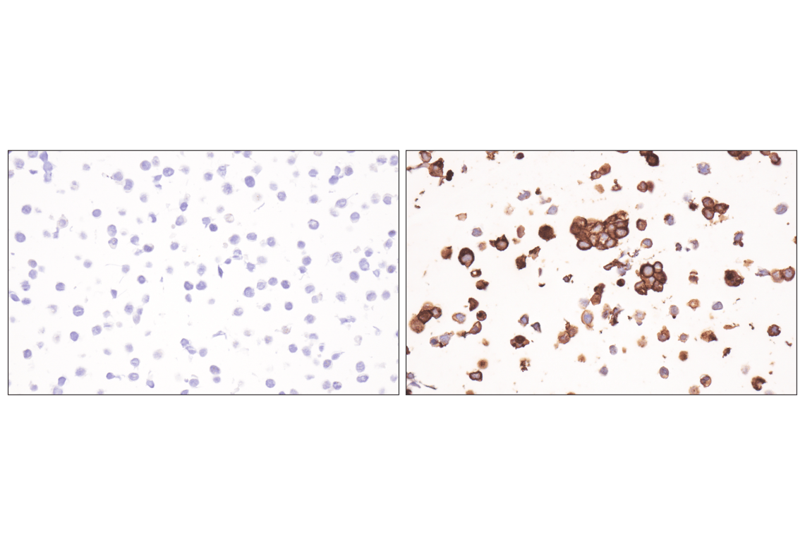 Immunohistochemistry Image 7: ESAM (F9D9P) Rabbit mAb