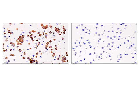 Immunohistochemistry Image 8: RIP (E8S7U) XP<sup>®</sup> Rabbit mAb