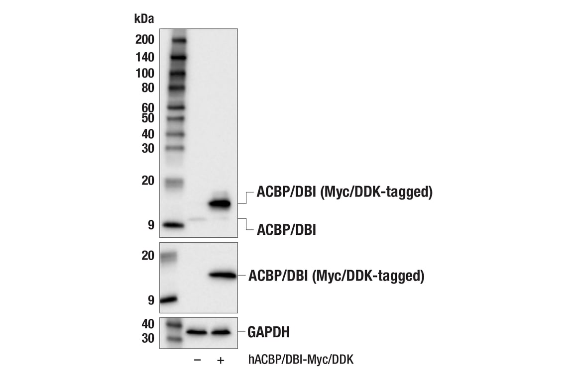 Western Blotting Image 2: ACBP/DBI (E4V8V) XP<sup>®</sup> Rabbit mAb