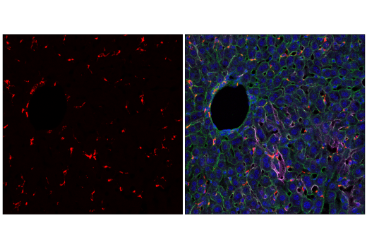 Immunofluorescence Image 1: CD68 (E3O7V) Rabbit mAb (Alexa Fluor<sup>®</sup> 647 Conjugate)