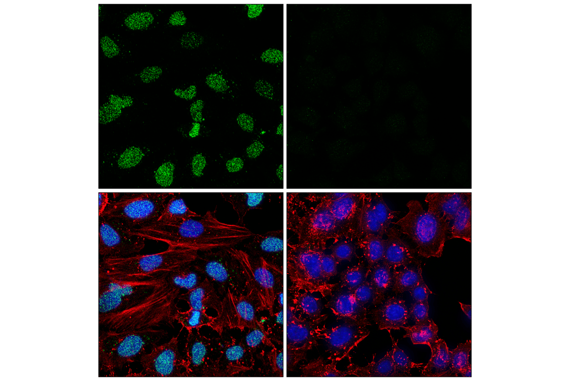 undefined Image 15: Parthanatos Antibody Sampler Kit